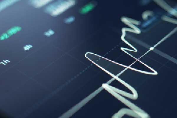 万腾Vatee 2025.6.3原油市场分析报告